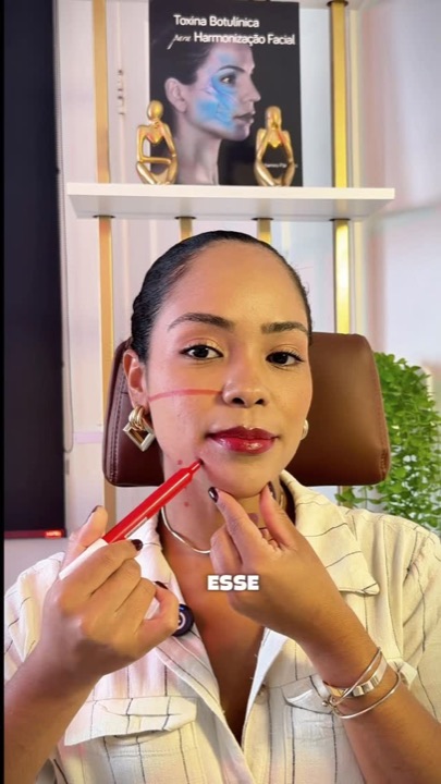 Reel da Dra. Jênifer sobre botox depois dos 30
