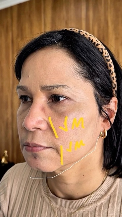 Reel da Dra. Jênifer: full face