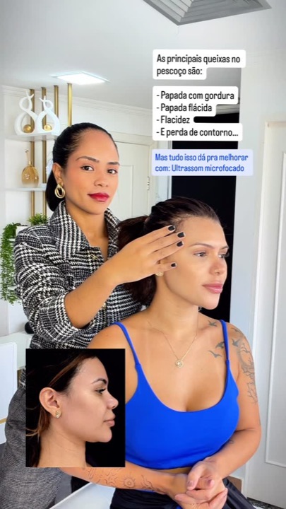 Reel da Dra. Jênifer: papada em movimento